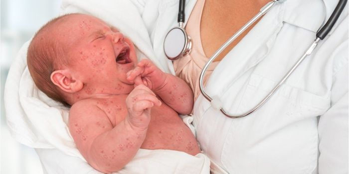 The US May Lose Its Measles Elimination Status