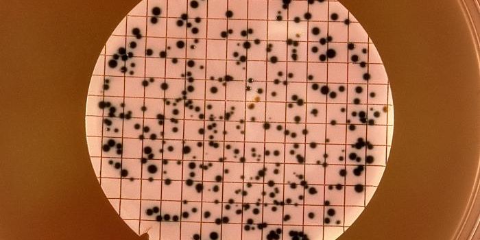 Human Hormones Promote Drug Resistance in Gonorrhea Pathogen