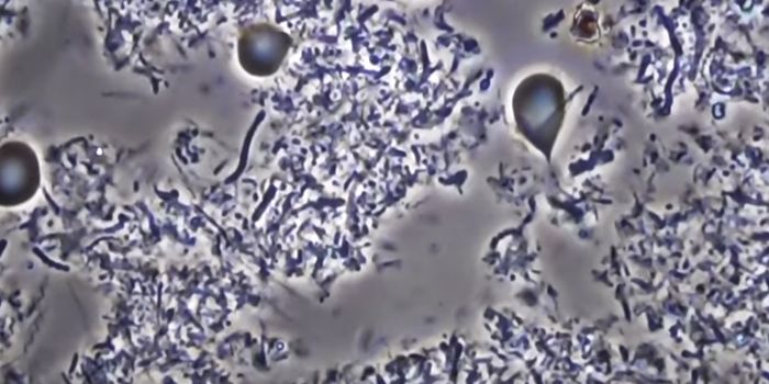 The Microbial Communities That Form on the Tongue