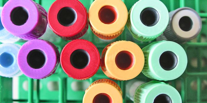 Biomarker in Blood Test May Have Early Cancer Answer