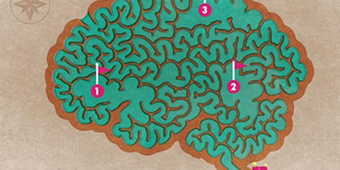 Video Game Assists in Diagnosis of Alzheimer Disease