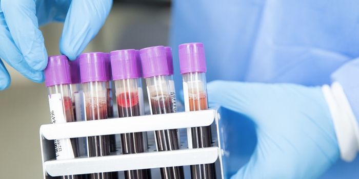 New Test for Rare Neurological Disease Recommended for Kids with Symptoms