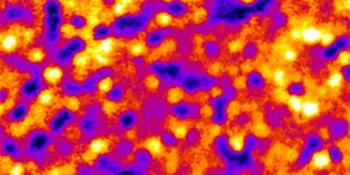 Getting a Better Look at Patterns in Layers of Cells in the Eye
