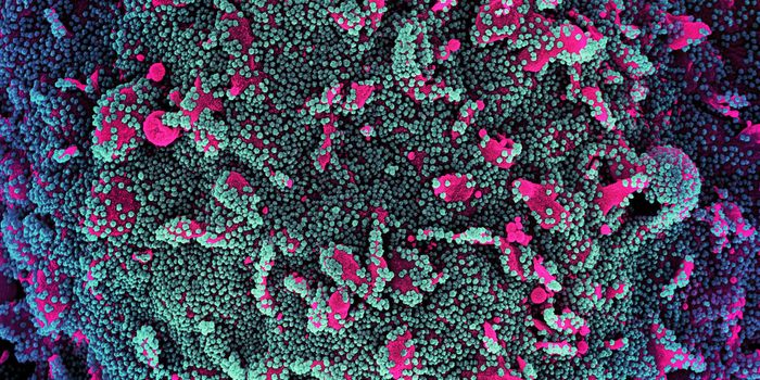 Stressing the Importance of Acknowledging Airborne COVID-19 Transmission