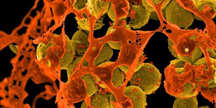 Why Staph Infections are Only Severe for Some