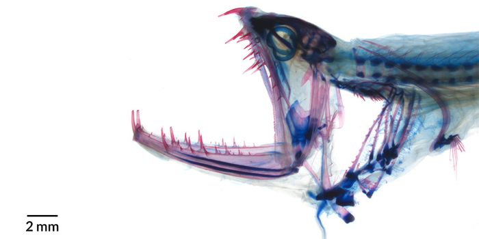 Why Are Dragonfish Able to Open Their Mouths So Wide?