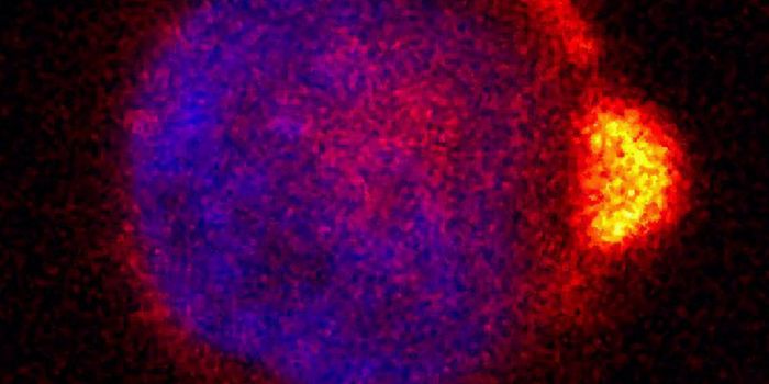Polarity of Cancer Cells Affects Metastatic Ability