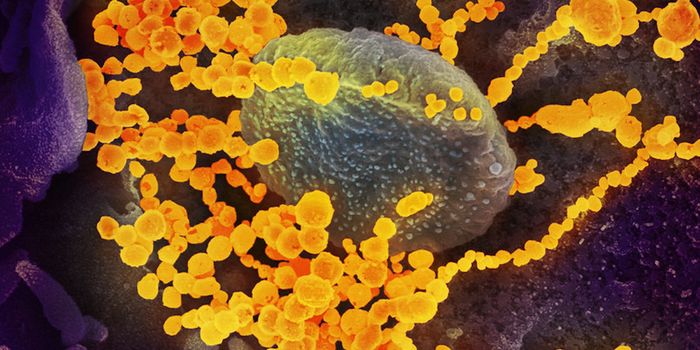 How Many COVID-19 Cases Have There Really Been?