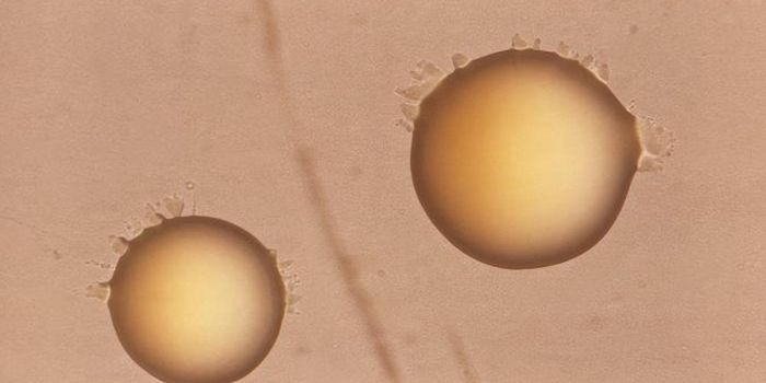 Genetic Risk Factors Make Some People Susceptible to Common Microbes