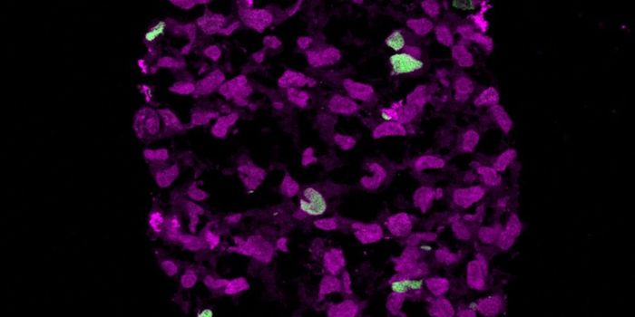 Oncologists Share Reasons for Cancer Drugs' High Cost, Recommend Solutions