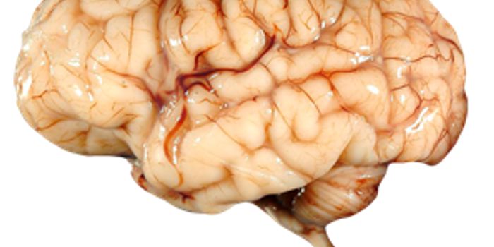 Similarities and Differences Between Human and Monkey Brains
