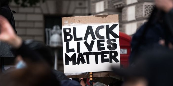 Why Are There So Few Black People in STEM?