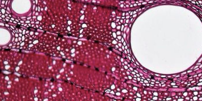 Newly Found Enzyme can Help Turn Plant Waste to Plastic