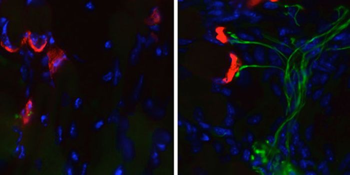 Fighting Disease Targeting Children