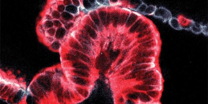 Breakthrough Imaging Tool Shows How Pancreatic Cancer Forms