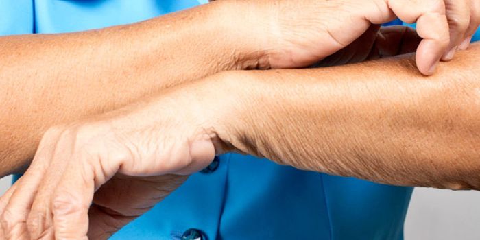 Mysteriously itchy? Blame your immune system