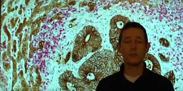 Assessing a Matrix Surrounding Cancer Cells