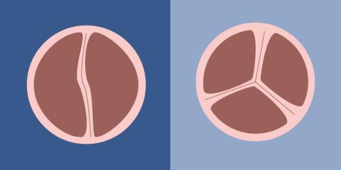 Two Genetic Variants Discovered in Association with Bicuspid Aortic Valve Disease