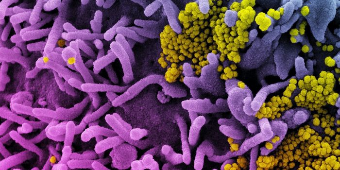J&J COVID-19 Vaccine Reaction Clusters Caused by Anxiety