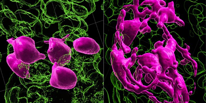 Hair Turns Grey When Stem Cells Get Stuck