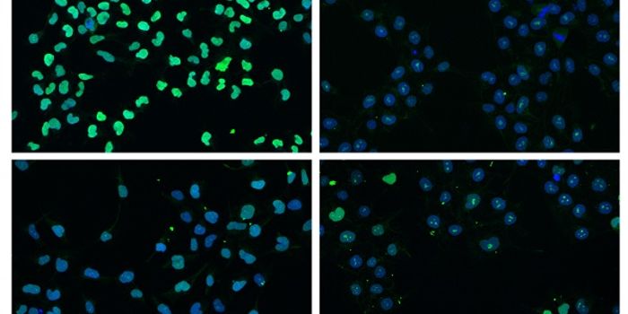 Key Moment in Stem Cell Growth Brought to Light