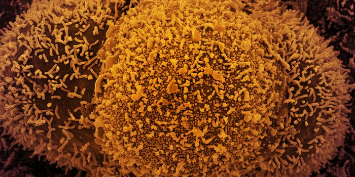 Cell Atlas Helps Explain the Deadly Nature of SARS-CoV-2