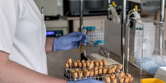 New Test Predicts Lupus Onset