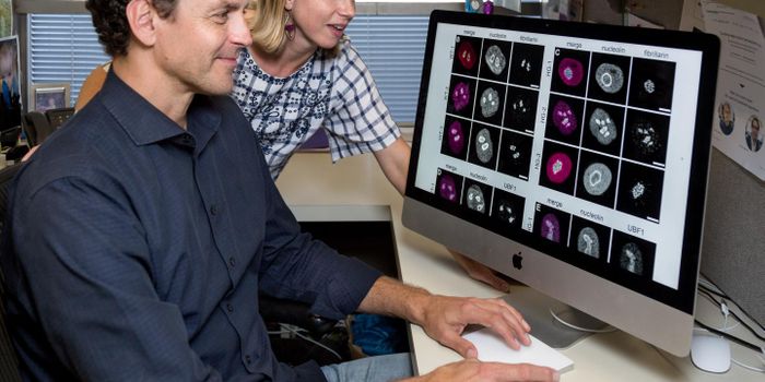 Cellular Protein Turnover Linked to Aging