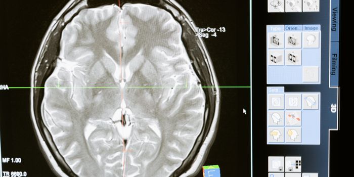 High Amounts of TV Watching for Middle-aged Adults Could Cause Cognitive Decline