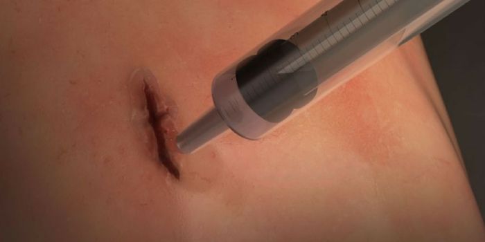 A Surgical-Grade 'Caulk' For Wounds?