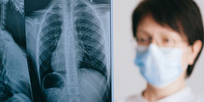 Sonic Hedgehog gene speeds up large-scale bone regeneration