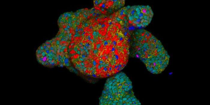 How Rare Intestinal Cells May Work as a Kind of Therapeutic Sensor