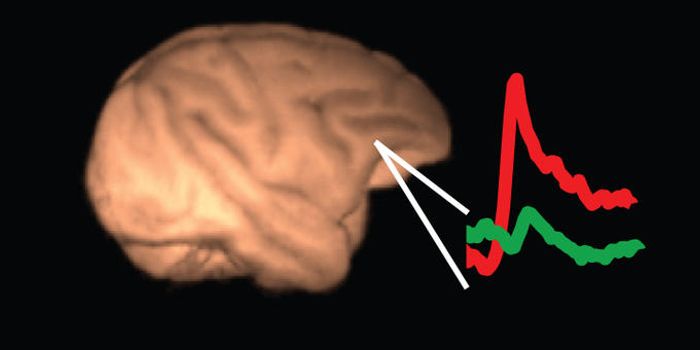 Detecting Alzheimer's Early