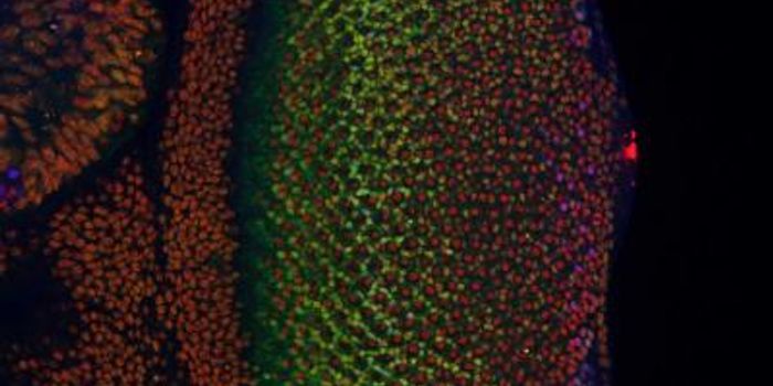 Researchers Pinpoint Where Cancer Cells Begin