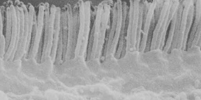 Advanced Molecular Diagnostics for Microvillus Inclusion Disease