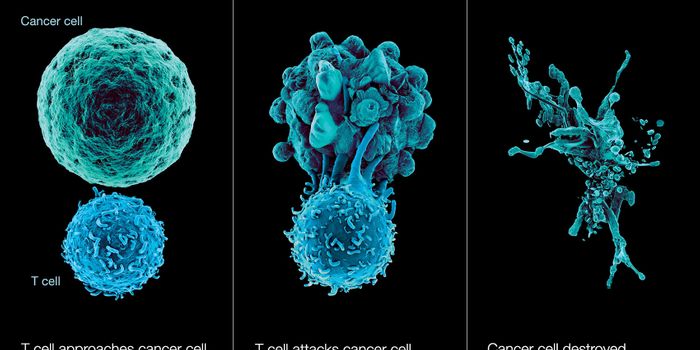 Combination Therapy for Advanced Melonoma