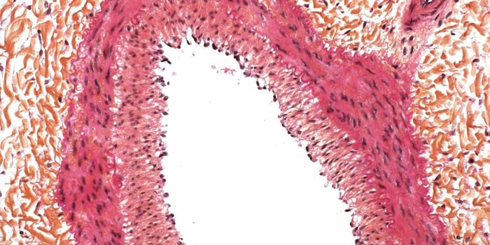 Refocusing Smooth Muscle Cells to Prevent Heart Attack