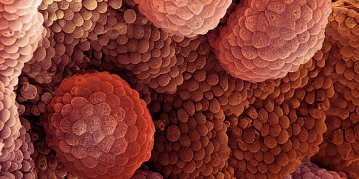 Paving the Way to Earlier Prostate Cancer Diagnosis