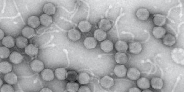 The Viral Link to Irritable Bowel Disease