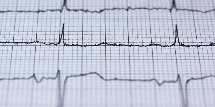 New Device Protects Esophagus During Cardiac Ablation