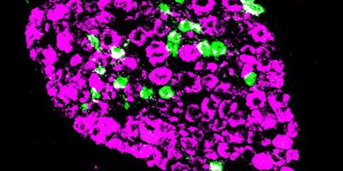 Scratching a Chronic Itch