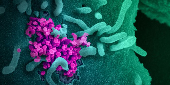 Blood Vessel Damage Caused by COVID-19 Disrupts Brain