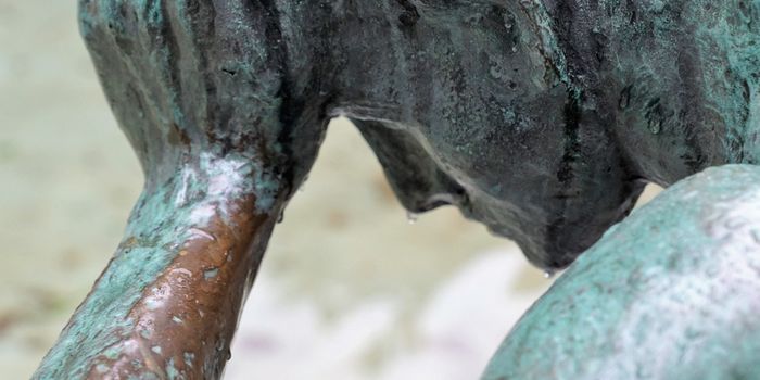 Migraine with Aura Linked to Previously Unknown Brain Pathway