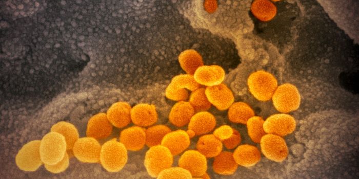 Low Vitamin D Levels Linked to COVID-19 Mortality