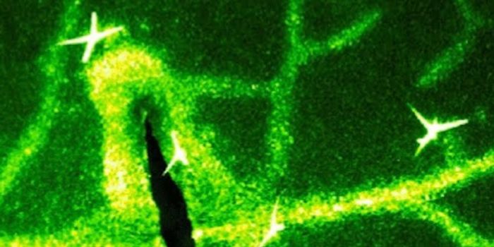 A Plant 'Nervous System' is Found