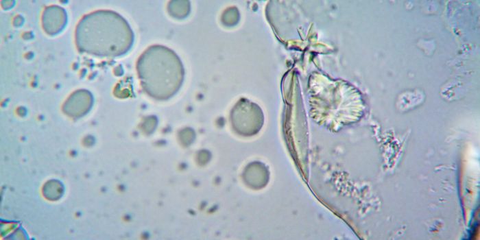 Substantial Monkeypox Transmission Happens Before Symptoms Are Recognized