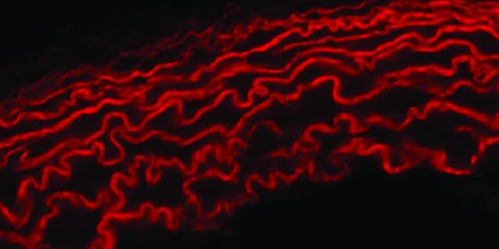 The Dynamic Duo That Protects Us From Aortic Aneurysms