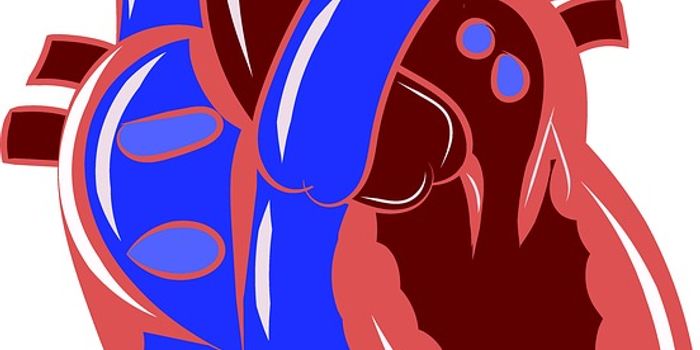 Intervention for Endocarditis- What Kind of Valve is Best?