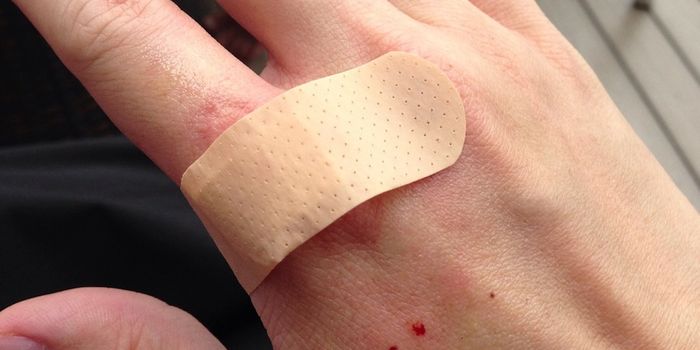 Wounds Sustained at Night Heal More Slowly