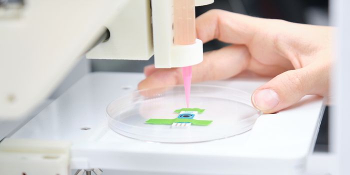 Novel 3D Bio-printed Leukemia Model Shows Potential for Treatment Testing Platform